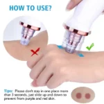Vacuum Blackhead Remover Face Black Spots Cleaner White Dot Pimple Removal - Image 4